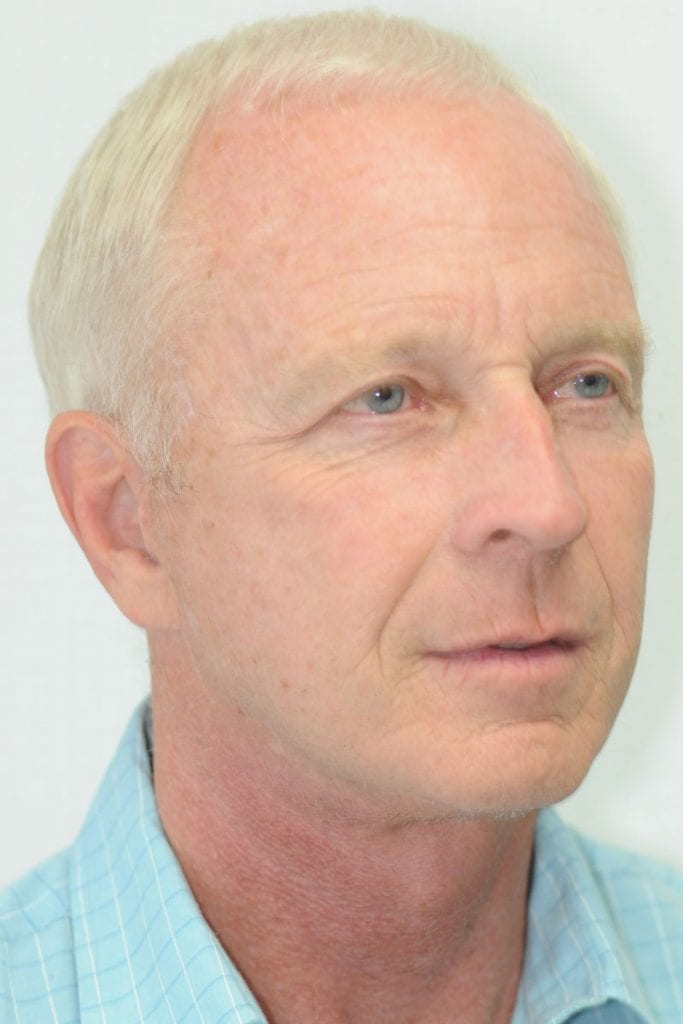 male-facelift-patient-03 After - 2