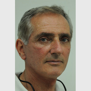 male-facelift-patient-05 After - 2