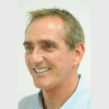 male-facelift-patient-05 After - 3